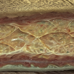 Imagen macroscópica de una mano humana mostrando las capas de tejido graso y muscular bajo la piel.